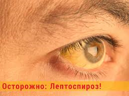 Лептоспироз